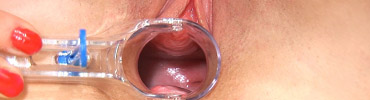 Speculum Close Up