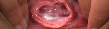 Discharge Close Up